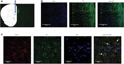 Corticostriatal Regulation of Acute Pain